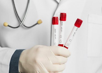Coronavírus em Teresina: pesquisa inicia nova etapa de testes rápidos neste domingo